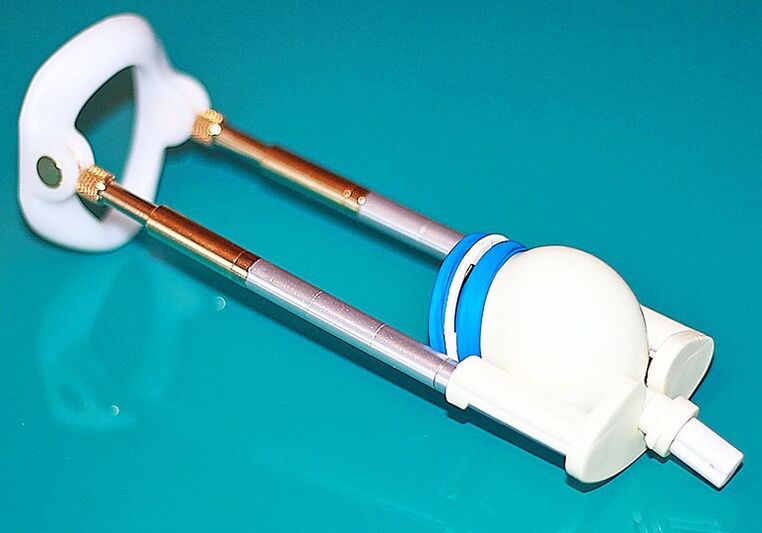 екстендер за повећање пениса